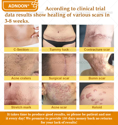 ADNOON® Bee Venom Advanced Skin Repair Cream, Anti-aging, Hydrating, Skin Repair, Even Tone, Acne and Dark Spot Treatment, Wart and Mole Removal, Psoriasis Relief