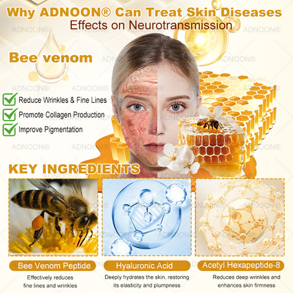 ADNOON® Bee Venom Advanced Skin Repair Cream, Anti-aging, Hydrating, Skin Repair, Even Tone, Acne and Dark Spot Treatment, Wart and Mole Removal, Psoriasis Relief