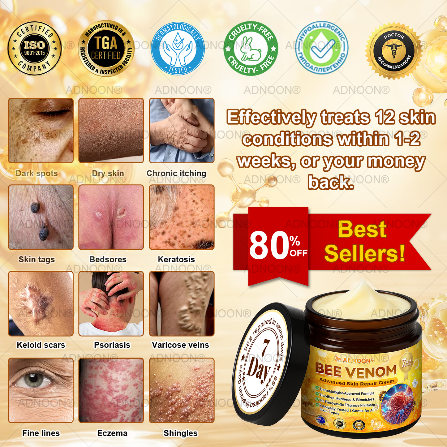 ADNOON® Bee Venom Advanced Skin Repair Cream, Anti-aging, Hydrating, Skin Repair, Even Tone, Acne and Dark Spot Treatment, Wart and Mole Removal, Psoriasis Relief